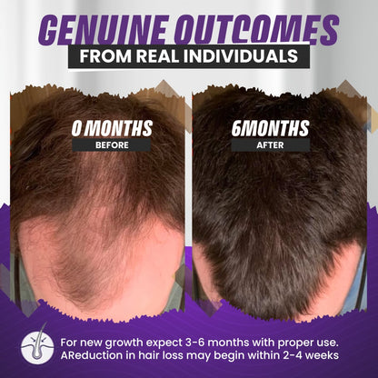 Nourish Growth - Hair Rescue Growth Serum