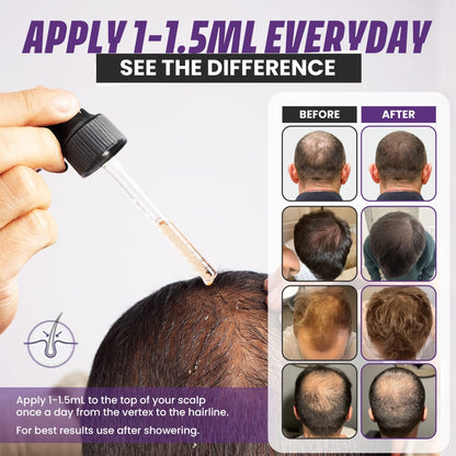 Nourish Growth - Hair Rescue Growth Serum